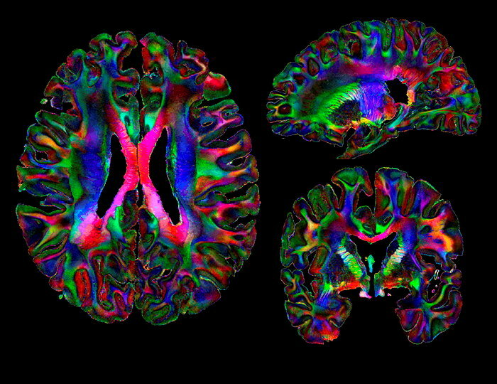 Stanislas Dehaene Les Secrets De Notre Cerveau Plus Fort Que L