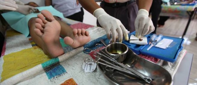 Un tribunal de Cologne a estime que "le corps de l'enfant etait modifie durablement et de maniere irreparable par la circoncision".