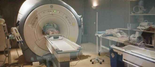 Grace a une nouvelle technologie d'analyse des donnees d'IRM, les chercheurs ont detecte des variations dans le cerveau de certains malades.