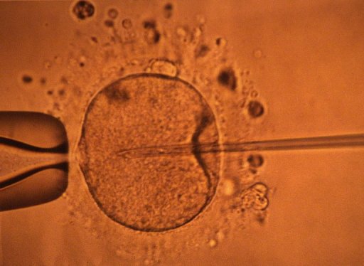 Catherine Lemorton, presidente PS de la commission des Affaires sociales de l'Assemblee nationale, a estime jeudi que le gouvernement etait pret a revenir sur l'interdiction de la recherche sur les embryons.