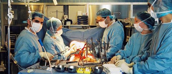 La transplantation d'organes a necessite de longues annees de recherche avant de devenir un geste presque quotidien.