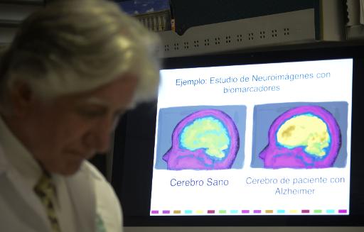 En Colombie, une &quot;mal&eacute;diction&quot; pour gu&eacute;rir la plan&egrave;te d'Alzheimer