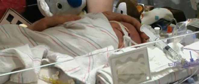 Etats Unis Un Bebe De Six Jours Plus Jeune Transplante Du Coeur Le Point