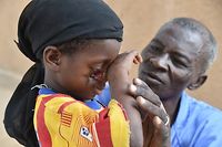 Niger: le noma, &eacute;pouvantable maladie de la mis&egrave;re et de la malnutrition