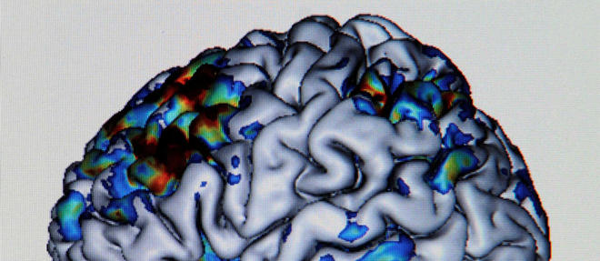 Image d'IRM d'un cerveau (illustation).
