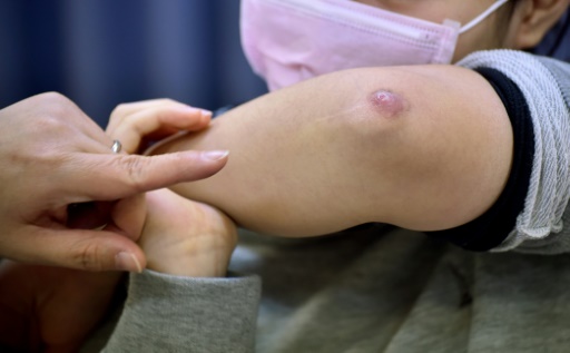 La mère d'une fillette montre le bras de sa fille blessée lors d'une classe le 11 novembre 2015 à Tokyo  © KAZUHIRO NOGI AFP