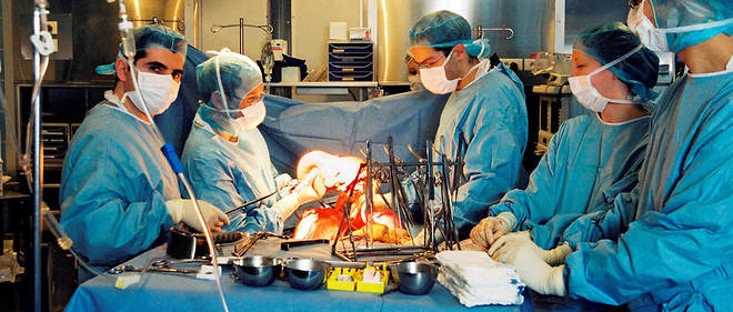 Au bloc operatoire, un foie est preleve par une equipe de chirurgiens specialisee   a l'hopital Cochin, a Paris.