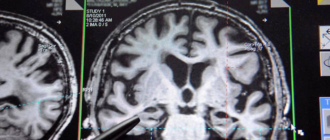 IRM du cerveau (photo d'illustration).