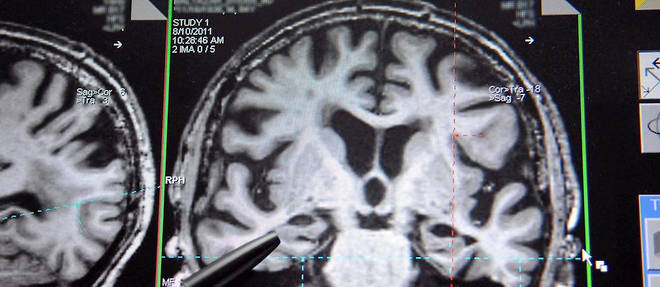 IRM du cerveau (photo d'illustration).