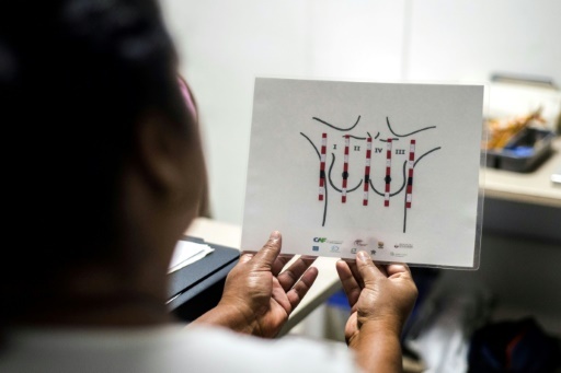 Alors qu'une femme qui s'autoexamine peut détecter des nodules de 15 à 20 mm et un médecin de 10 mm, les auxiliaires aveugles en détectent de plus petits, de huit mm. © Luis ROBAYO AFP