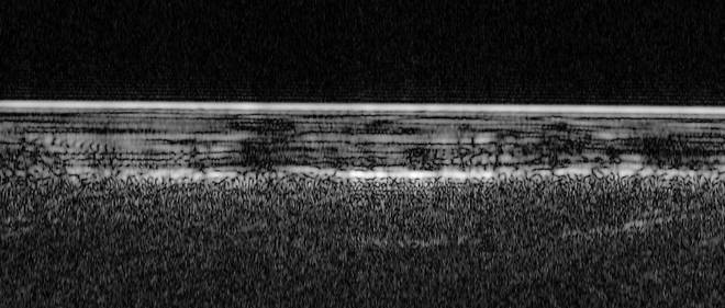 Sur cette image radar se cache la premiere etendue d'eau liquide jamais decouverte sur Mars. Un lac pour le moins sale cache sous la glace a 1,5 kilometre de profondeur.