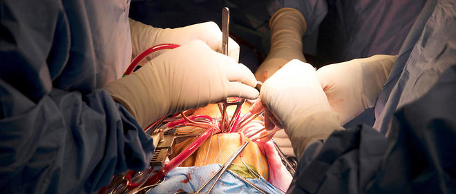 En 1953 s'ouvre le champ de la chirurgie a coeur ouvert.