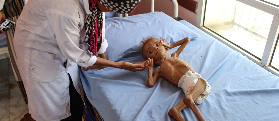 Guerre au Yemen: plus de cinq millions d'enfants menaces de famine