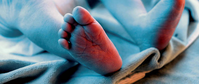 L'incidence des malformations est estimee en France a 1,7 cas pour 10 000 naissances, soit environ 150 cas par an.
