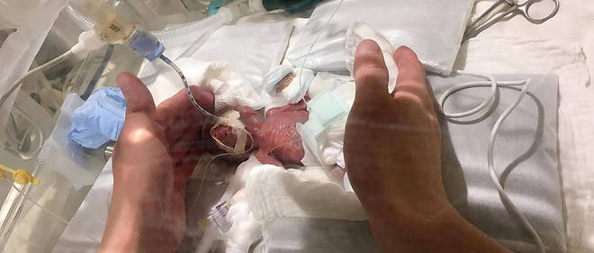 Le bebe etait si petit a la naissance qu'il tenait dans la paume de la main d'un adulte.