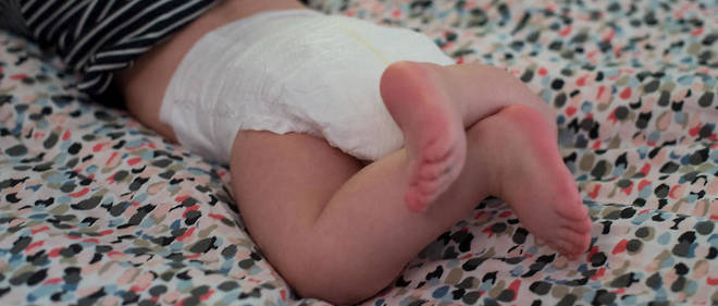 Les bebes ont developpe une pilosite tres anormale. (Illustration)