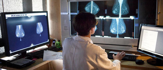 Le cancer du sein reste la forme la plus frequente chez les femmes et le deuxieme cancer le plus mortel.
