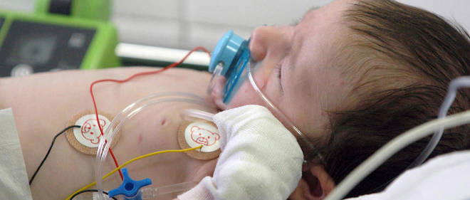 Un enfant souffrant de bronchiolite est sous perfusion au service des urgences de l'hopital Trousseau a Paris.
