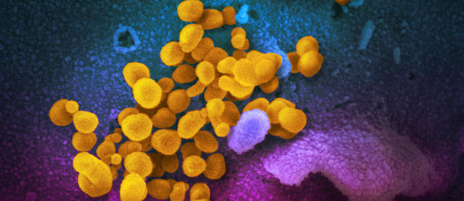 Vue au microscope du nouveau coronavirus Sars-CoV-2 (en jaune).  
