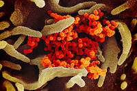 Coronavirus&nbsp;: le r&eacute;chauffement climatique a-t-il favoris&eacute; l'&eacute;pid&eacute;mie&nbsp;?