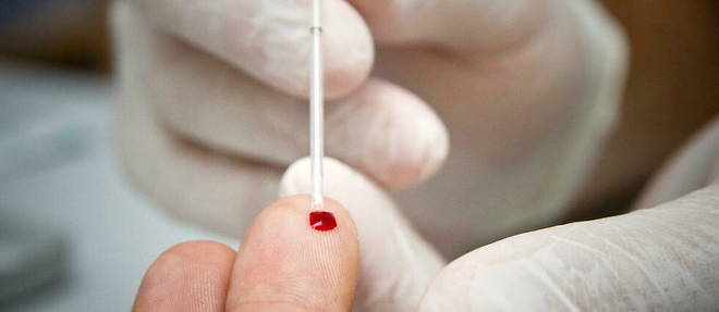 Un test de depistage rapide du virus du sida. 

