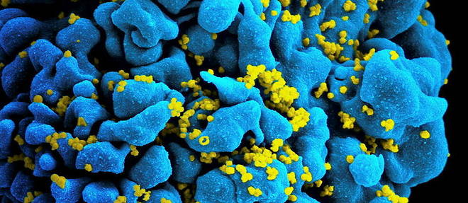 Une cellule H9 infectee par le VIH (illustration).
