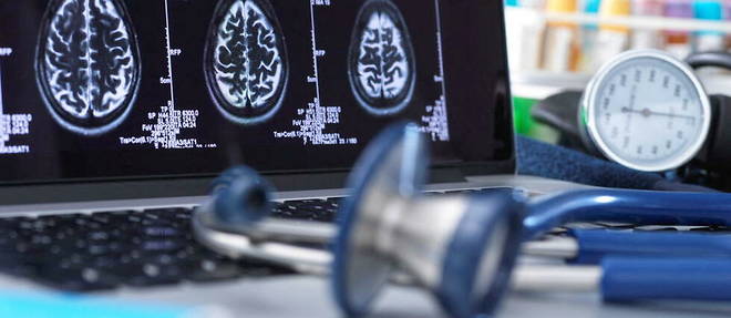 L'image d'un scanner cerebral (photo d'illustration).
