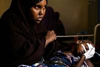 Somalie: dans un h&ocirc;pital de Mogadiscio, l'afflux des enfants victimes de la s&eacute;cheresse