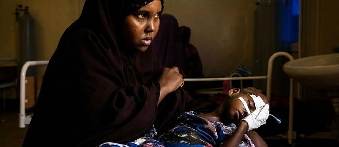 Somalie: dans un hopital de Mogadiscio, l'afflux des enfants victimes de la secheresse
