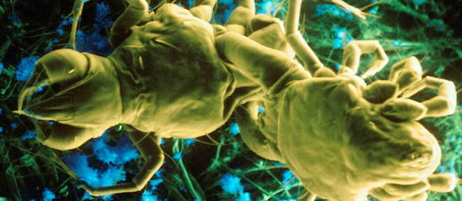 Des chercheurs ont decouvert que certains acariens sont progressivement en train de fusionner avec la peau des humains. (image d'illustration)
