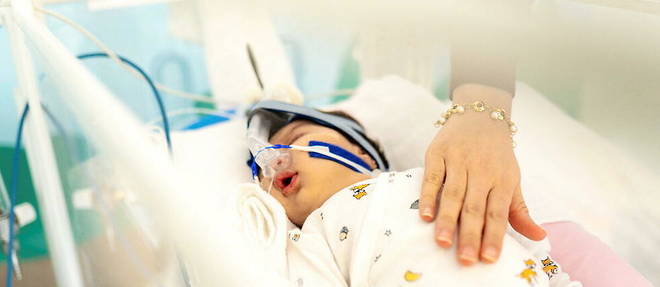L'epidemie de bronchiolite accentue la crise dans les services de pediatrie hospitaliere.
