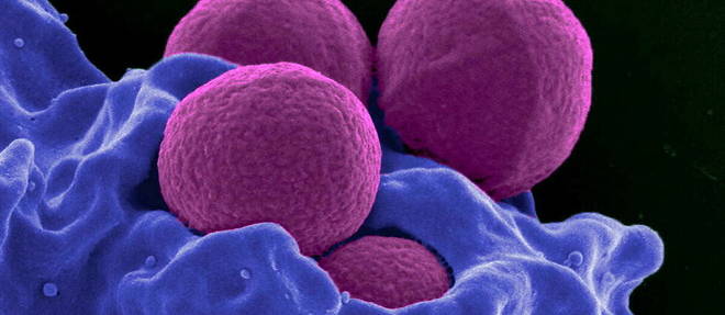 Staphylococcus aureus.
