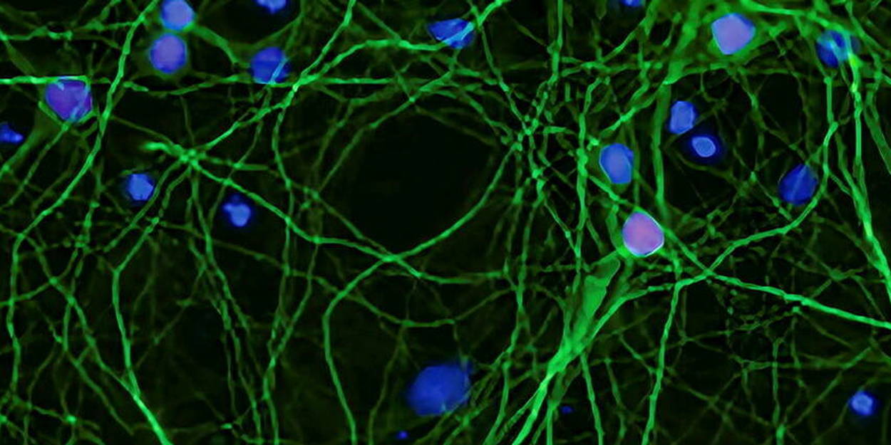 Maladie De Charcot : Ce Qu’il Faut Savoir Sur Cette Maladie Dégénérative