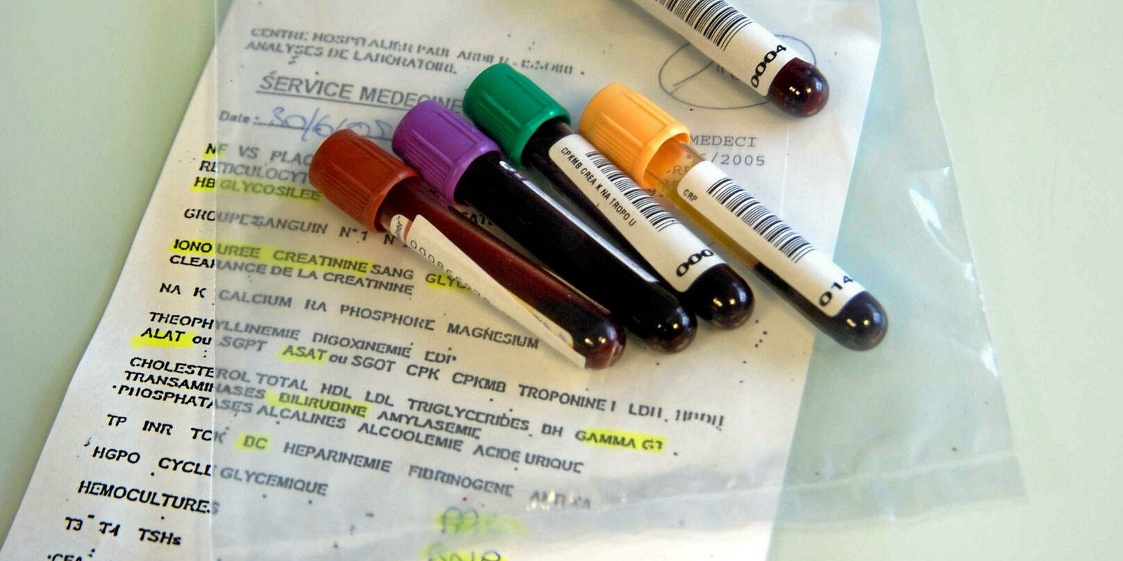 How to correctly interpret your blood test results