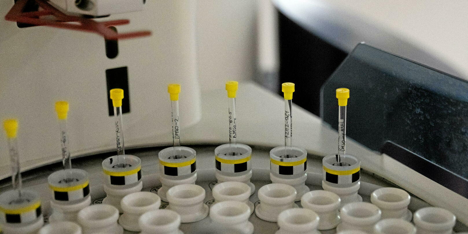 Diagnostic d’Alzheimer : un nouveau test en 5 minutes